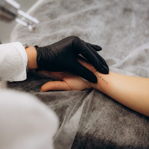 Beautician using laser device to remove an unwanted tattoo from female arm. Concept of erasing t